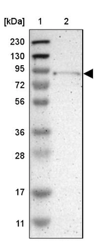 Lane 1: Marker [kDa] 230, 130, 95, 72, 56, 36, 28, 17, 11_br/_Lane 2: Human cell line RT-4