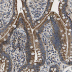 Anti-HADHA Antibody