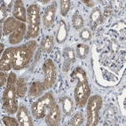 Immunohistochemical staining of human kidney shows moderate to strong cytoplasmic positivity in cells in tubules.
