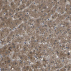 Immunohistochemical staining of human liver shows strong cytoplasmic positivity in hepatocytes.