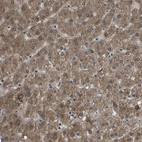 Immunohistochemical staining of human liver shows strong cytoplasmic positivity in hepatocytes.