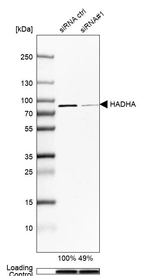 Western blot analysis in Hep-G2 cells transfected with control siRNA, target specific siRNA probe #1, using Anti-HADHA antibody. Remaining relative intensity is presented. Loading control: Anti-GAPDH.