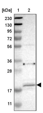 Lane 1: Marker [kDa] 230, 130, 95, 72, 56, 36, 28, 17, 11_br/_Lane 2: Human cell line RT-4