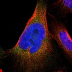 Immunofluorescent staining of human cell line U-251 MG shows localization to endoplasmic reticulum.