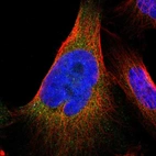 Immunofluorescent staining of human cell line U-251 MG shows localization to endoplasmic reticulum.