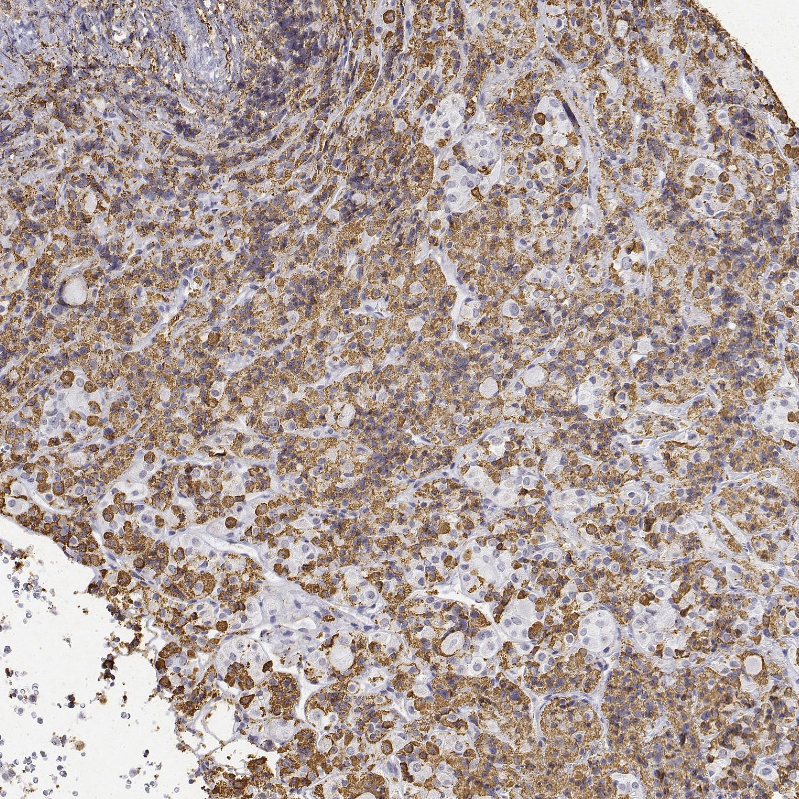 Anti-NEUROD4 Antibody