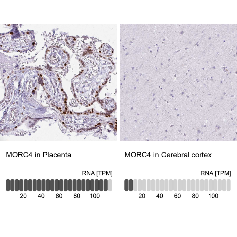 Anti-MORC4 Antibody
