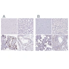 Immunohistochemical staining of human cerebral cortex, kidney, placenta and testis using Anti-MORC4 antibody HPA015547 (A) shows similar protein distribution across tissues to independent antibody HPA000395 (B).