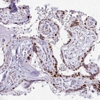 Immunohistochemical staining of human placenta shows moderate nuclear positivity in trophoblastic cells.