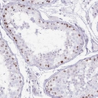 Immunohistochemical staining of human testis shows moderate nuclear positivity in cells in seminiferous ducts.