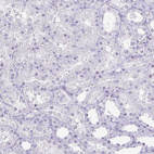 Immunohistochemical staining of human kidney shows no positivity in cells in tubules.