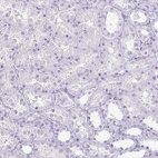 Immunohistochemical staining of human kidney shows no positivity in cells in tubules.