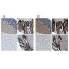 Anti-WNK2 Antibody