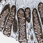 Immunohistochemical staining of human colon shows strong cytoplasmic positivity in glandular cells.
