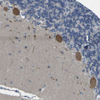 Immunohistochemical staining of human cerebellum shows moderate cytoplasmic positivity in Purkinje cells.