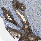 Immunohistochemical staining of human prostate shows strong cytoplasmic positivity in glandular cells.