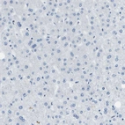 Immunohistochemical staining of human liver shows no positivity in hepatocytes as expected.