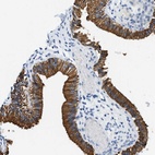 Anti-STXBP2 Antibody