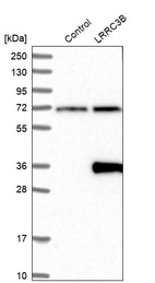 Anti-LRRC3B Antibody