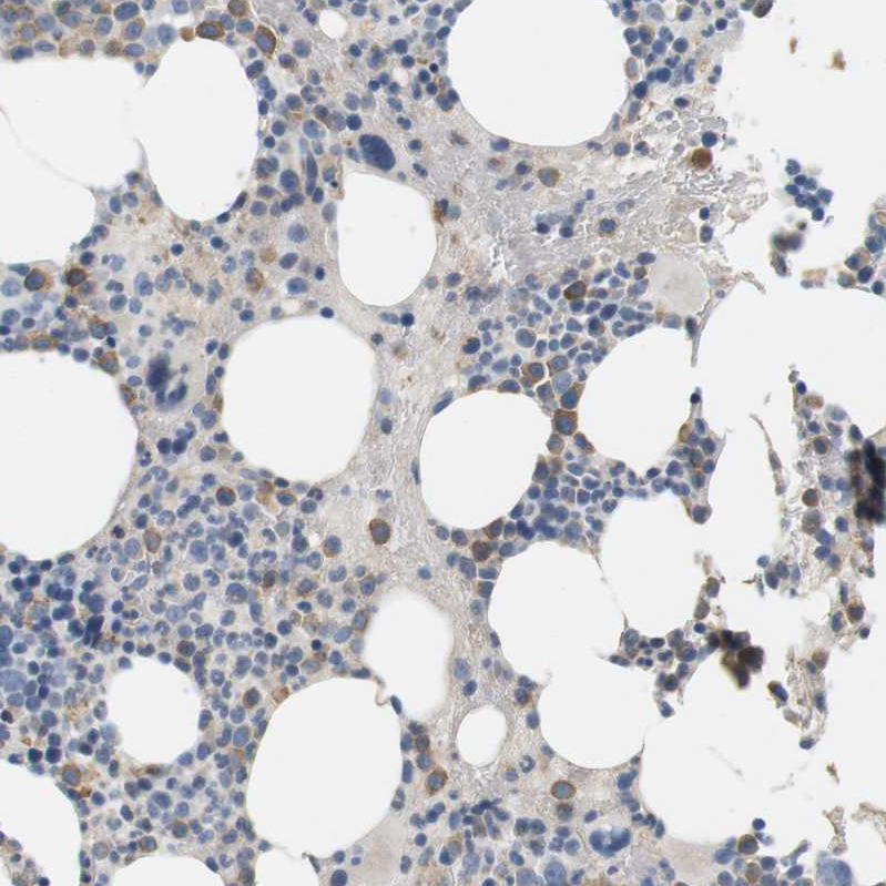 Anti-CD300E Antibody