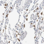 Immunohistochemical staining of human lung shows moderate to strong cytoplasmic positivity in macrophages.