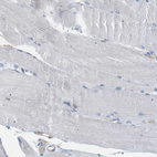 Immunohistochemical staining of human skeletal muscle shows no positivity in myocytes as expected.