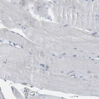 Immunohistochemical staining of human skeletal muscle shows no positivity in myocytes as expected.