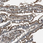 Anti-GPR161 Antibody
