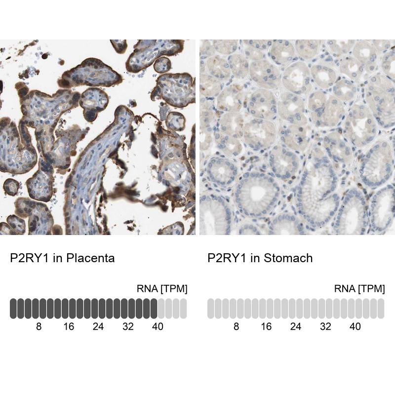 Anti-P2RY1 Antibody