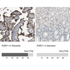 Anti-P2RY1 Antibody