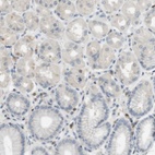 Immunohistochemical staining of human stomach shows low expression as expected.
