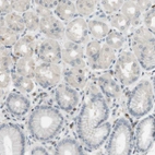 Immunohistochemical staining of human stomach shows low expression as expected.