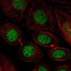 Immunofluorescent staining of human cell line SiHa shows localization to nucleoplasm.