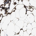 Immunohistochemical staining of human bone marrow shows high expression.