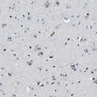 Immunohistochemical staining of human cerebral cortex shows low expression as expected.