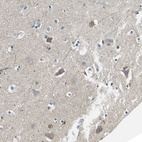 Anti-TMEFF2 Antibody