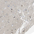Anti-TMEFF2 Antibody