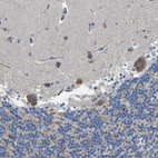 Immunohistochemical staining of human Cerebellum shows moderate granular cytoplasmic positivity in Purkinje cells.