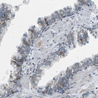 Immunohistochemical staining of human prostate shows weak granular cytoplasmic positivity in glandular cells.