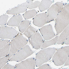 Immunohistochemical staining of human Skeletal muscle shows no positivity in myocytes as expected.