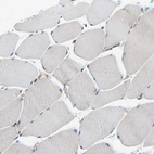 Immunohistochemical staining of human Skeletal muscle shows no positivity in myocytes as expected.