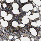 Anti-TBC1D15 Antibody