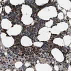 Anti-TBC1D15 Antibody