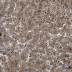 Immunohistochemical staining of human liver shows strong cytoplasmic positivity in hepatocytes.
