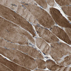 Immunohistochemical staining of human skeletal muscle shows strong cytoplasmic positivity in myocytes.