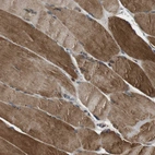 Immunohistochemical staining of human skeletal muscle shows strong cytoplasmic positivity in myocytes.