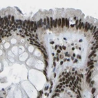 Immunohistochemical staining of human colon using Anti-NSRP1 antibody HPA015593.