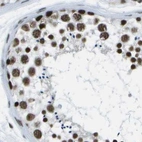 Immunohistochemical staining of human testis using Anti-NSRP1 antibody HPA015593.