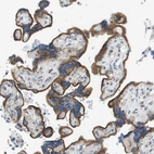 Anti-ACBD3 Antibody