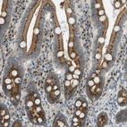 Immunohistochemical staining of human duodenum shows strong granular cytoplasmic positivity in glandular cells.